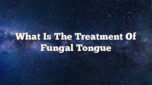 What is the treatment of fungal tongue