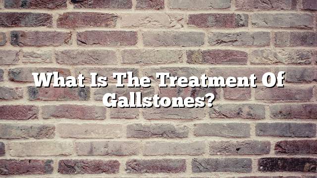 What is the treatment of gallstones?