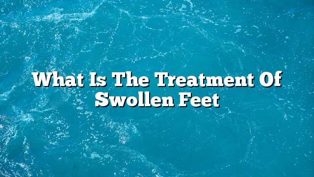 What is the treatment of swollen feet