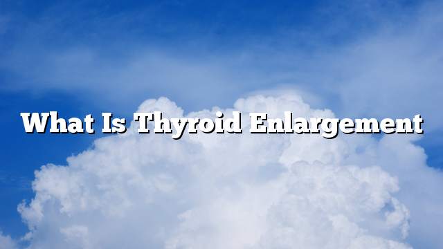 What is thyroid enlargement