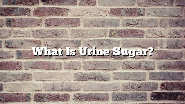 What is urine sugar?