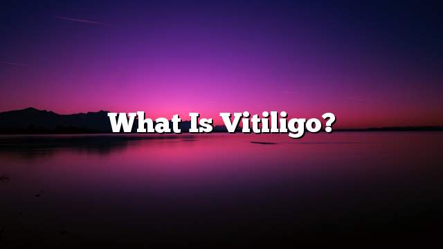 What is vitiligo?