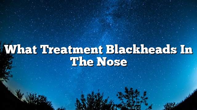 What treatment blackheads in the nose