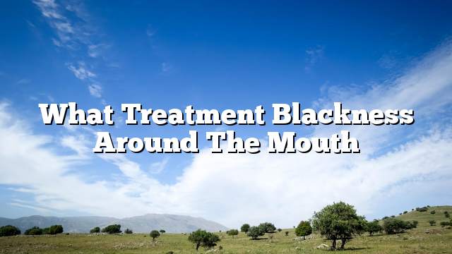 What treatment blackness around the mouth