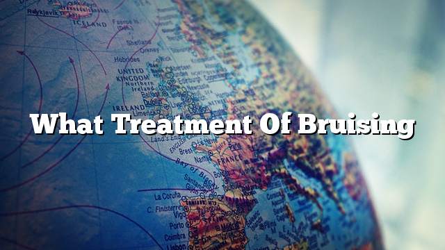 What treatment of bruising